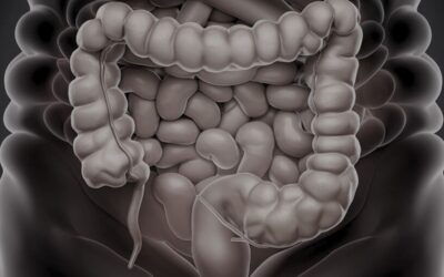 Síndrome de intestino irritable o colon irritable: Tu intestino es tu segundo cerebro